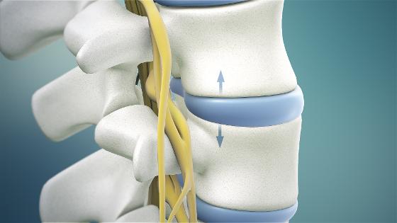 Spinal Decompression Machine - Genus Chiropractic - Torrance, California